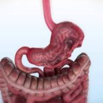 Cirugía del tercer espacio (POEM)