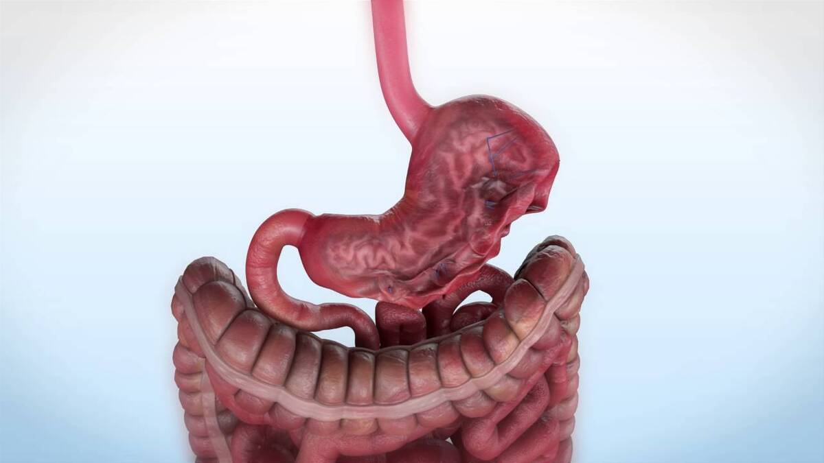 Cirugía del tercer espacio